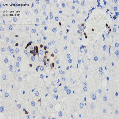 Pret-CD45 trušu PAB