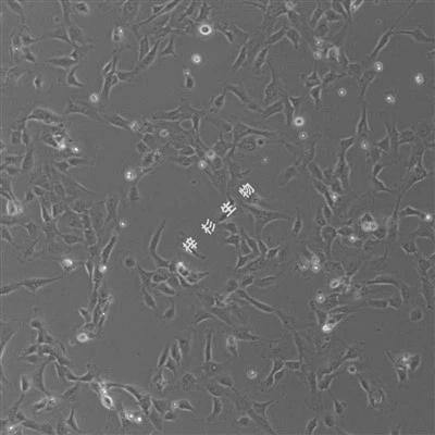SV40T transfektētās cilvēka nabas vēnas endotēlija šūnu (PUMC-HUVEC-T1) kultūras barotnes komplekts